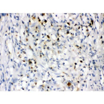 LCN2 / Lipocalin 2 / NGAL Antibody (aa21-198)