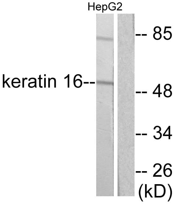 IHC-plus™ KRT16 / CK16 / Cytokeratin 16 Antibody (aa421-470)