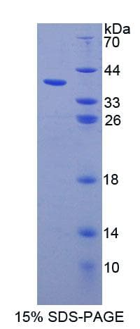 Human NAG20 / UBAP1 Protein (Recombinant His-T7)
