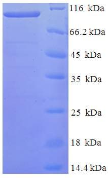 Human FAM160B1 Protein (Recombinant His-SUMO)