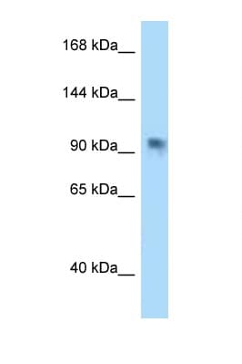 Polyclonal Rabbit anti-Human PARP8 Antibody (aa754-803, WB)