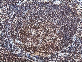 TIP48 / RUVBL2 Antibody (clone OTI1A6)