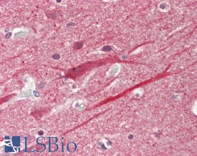 IHC-plus™ NAK / TBK1 Antibody (aa138-187)