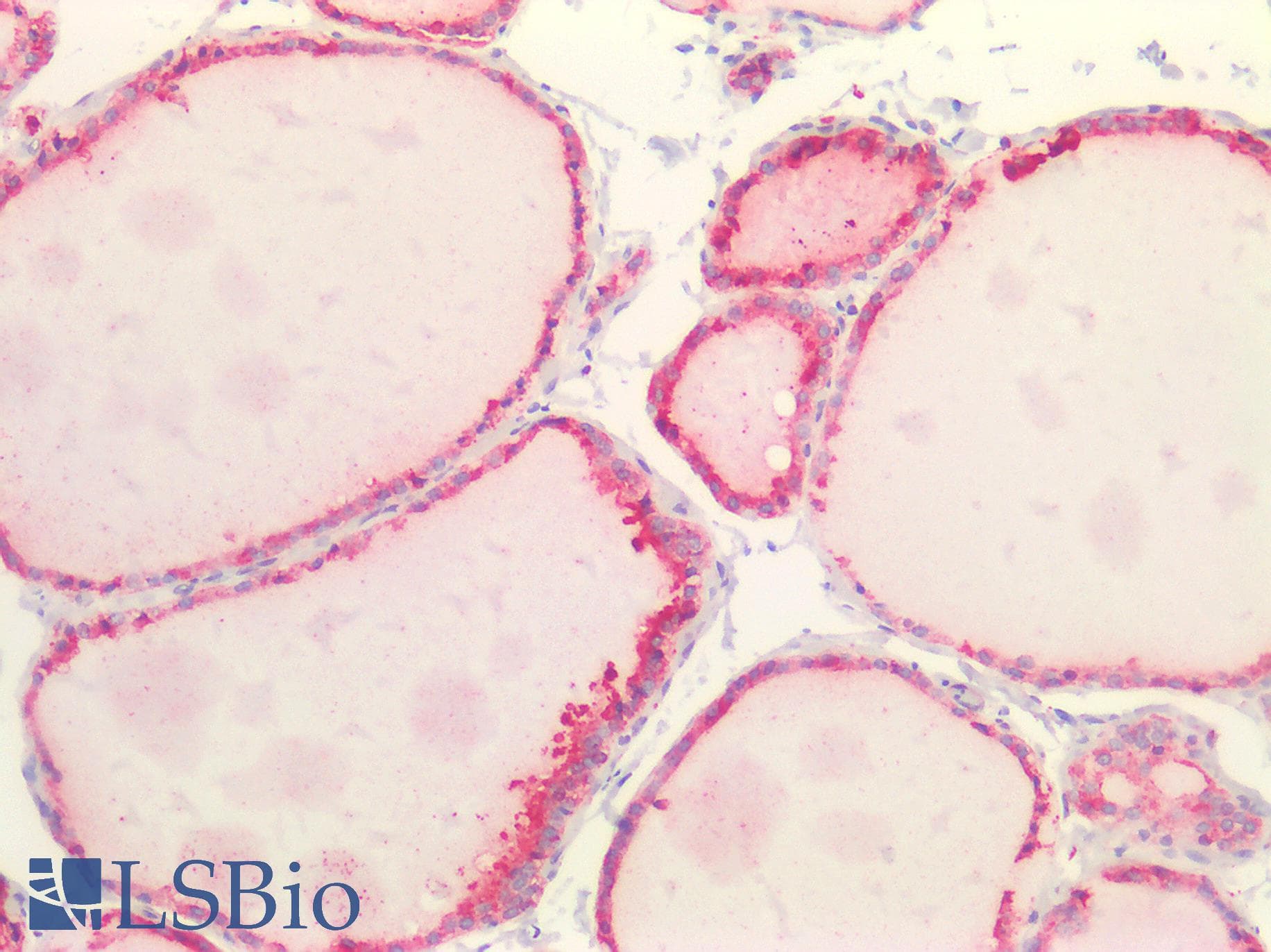 IHC-plus™ Polyclonal Rabbit anti-Human HSP90B1 / GP96 / GRP94 Antibody (aa16-43, IHC, IF, WB)