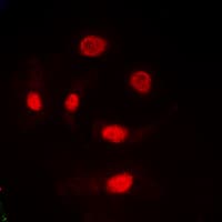 TRA2A Antibody (C-Terminus)
