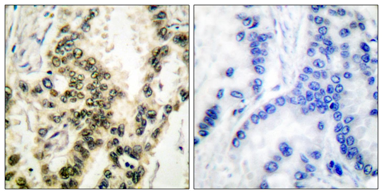 SRF / Serum Response Factor Antibody (phospho-Ser99)