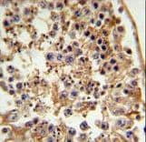 Polyclonal Rabbit anti-Human FANCC Antibody (aa527-555, IHC, IF, WB)