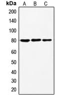 Polyclonal Rabbit anti-Human EZR / Ezrin Antibody (phospho-Thr567, IHC, WB)