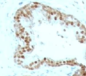 CDKN1C / p57 Kip2 Antibody (clone KIP2/880)