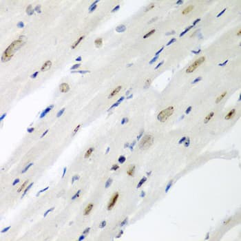 Polyclonal Rabbit anti-Human CDC27 Antibody (IHC, WB)