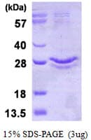 Human GPX3 Protein (Recombinant His)