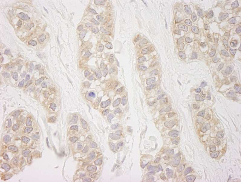 Polyclonal Rabbit anti-Human DDX19B Antibody (aa450-C-term, IHC)