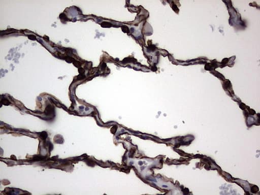 Monoclonal Mouse anti-Human KRT19 / CK19 / Cytokeratin 19 Antibody (clone OTI6E8, aa240-390, IHC)