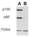 Monoclonal Mouse anti-Human CHAF1B / CAF1 Antibody (clone SS 53, WB)