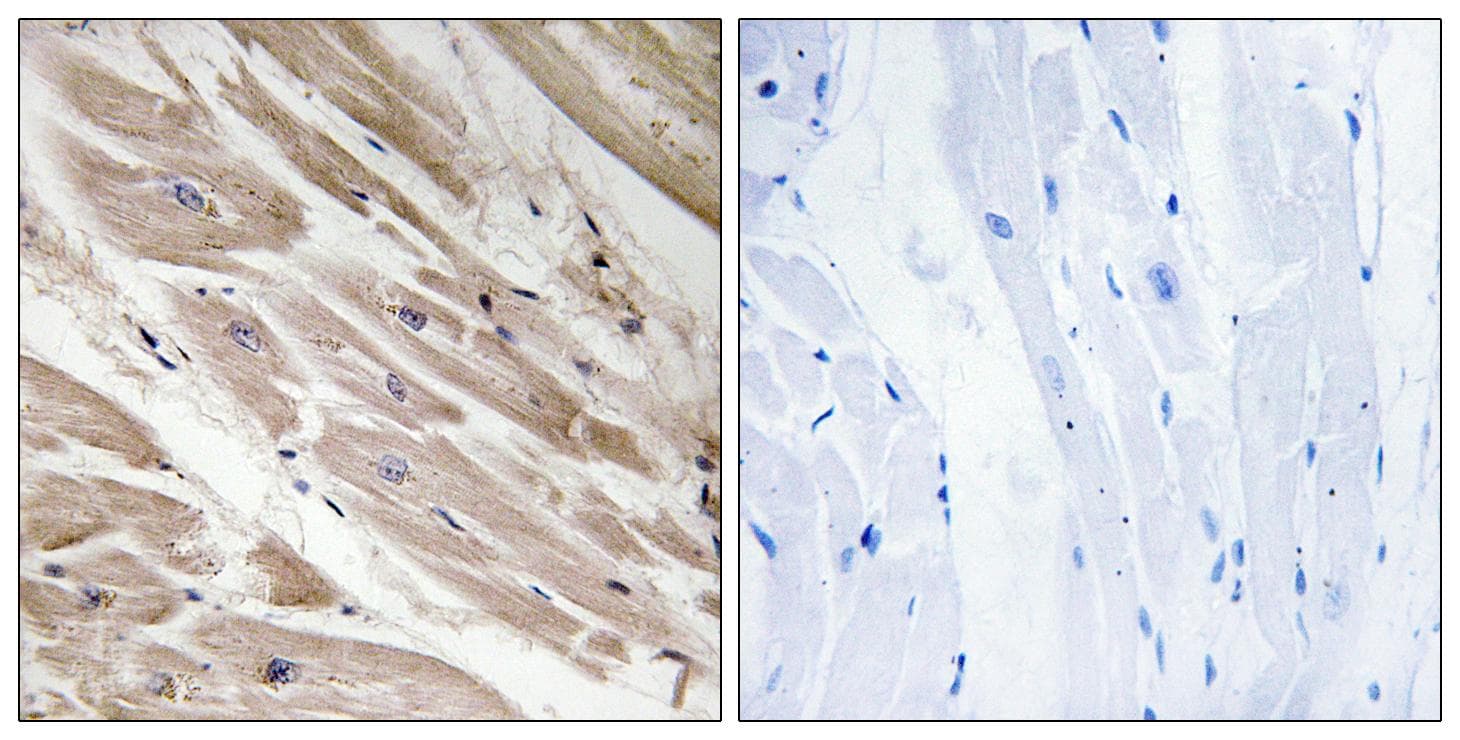 MYBPC3 / MYBP-C Antibody