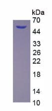 Mouse DKK1 Protein (Recombinant His-GST, N-terminus)