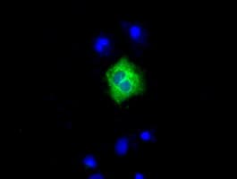 LIPG / Endothelial Lipase Antibody (clone OTI7C2)