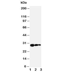 Polyclonal Rabbit anti-Human TIMP1 Antibody (aa189-207, IHC, WB)