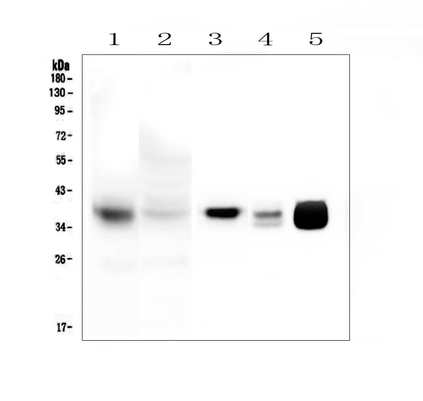Polyclonal Rabbit anti-Human MT-CO1 / COX1 Antibody (aa501-514, IHC, WB)