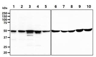 GSS / Glutathione Synthetase Antibody (clone AT12F2)