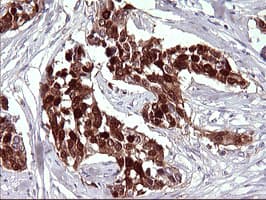 SERPINB3 Antibody (clone OTI1C10)