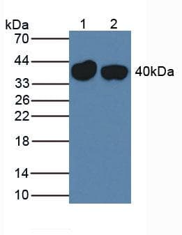 SERPINA7 / TBG Antibody (aa127-393)