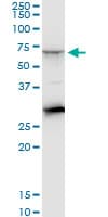 IHC-plus™ CTNS / Cystinosin Antibody (clone 5G6)