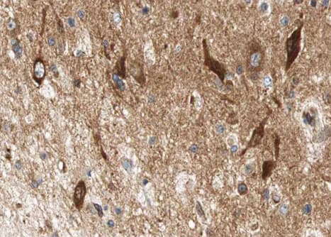 LIPE / HSL Antibody (phospho-Ser552)