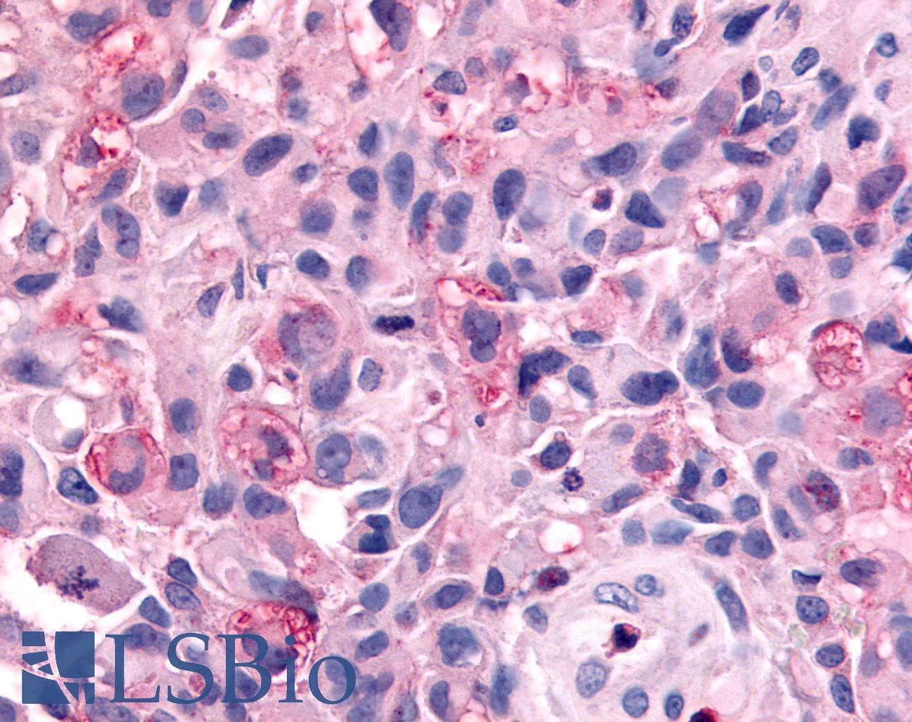 PathPlus™ WNK1 Antibody (C-Terminus)