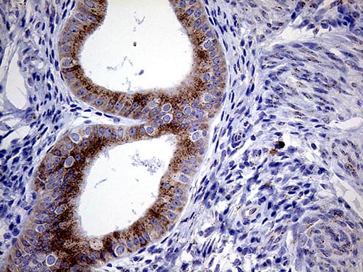Monoclonal Mouse anti-Human MYOT / Myotilin Antibody (clone OTI5E11, IHC, WB)