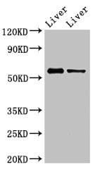 ER81 / ETV1 Antibody