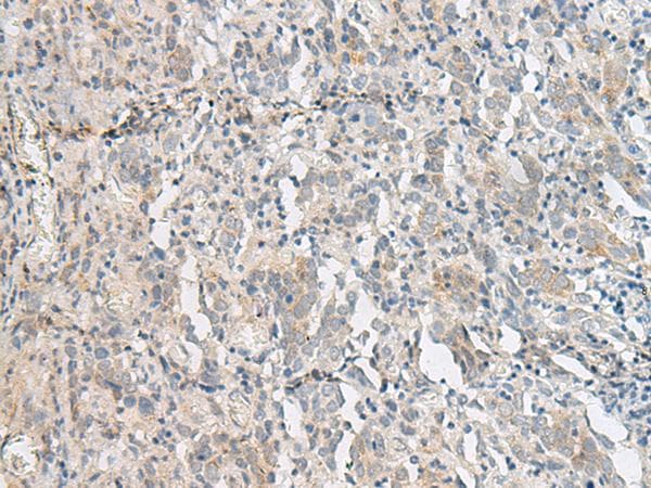 PC5 / PCSK5 Antibody