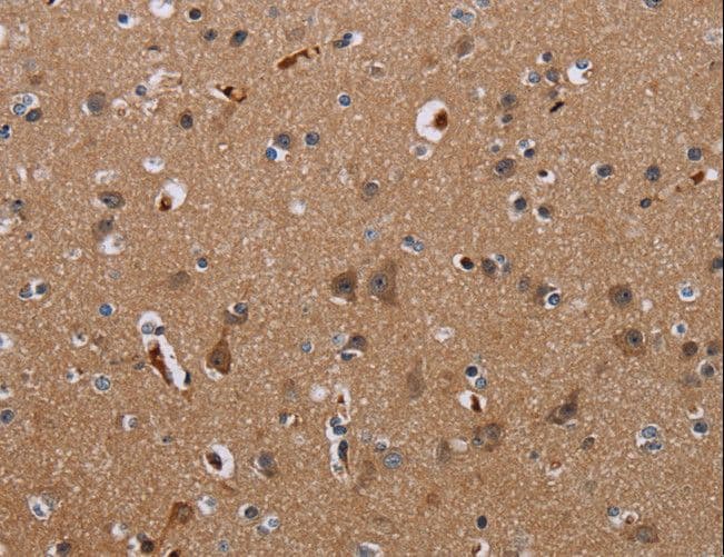 KLHL1 Antibody