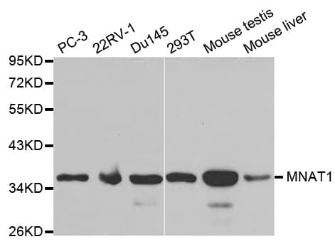 Polyclonal Rabbit anti-Human MNAT1 Antibody (IHC, IF, WB)