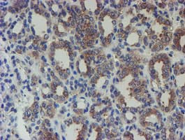 Monoclonal Mouse anti-Human SENP2 Antibody (clone OTI6F1, IHC, IF, WB)