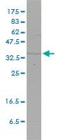 Monoclonal Mouse anti-Human FHL2 Antibody (clone 2G3-1A5, IF, WB)