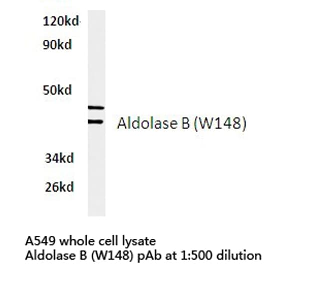ALDOB Antibody (Trp148)