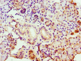 ASCC3 Antibody (aa1-111)