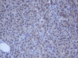 Monoclonal Mouse anti-Human DDX59 Antibody (clone OTI2G1, IHC, WB)