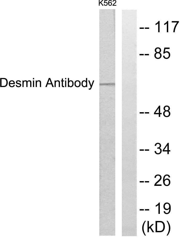 DES / Desmin Antibody (aa421-470)