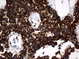 TAPBPL / TAPBPR Antibody (clone OTI1C9, Carrier-free)