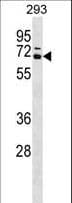PRMT4 / CARM1 Antibody (aa347-375)