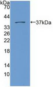 SYNE2 / Nesprin-2 Antibody (aa6-296)