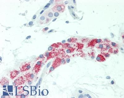 IHC-plus™ HSD17B8 / RING2 Antibody