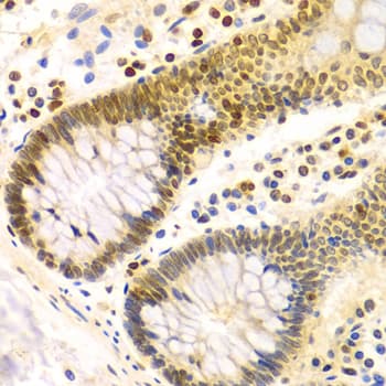 Polyclonal Rabbit anti-Human DKC1 / Dyskerin Antibody (IHC, IF, WB)