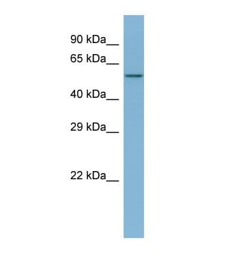 Polyclonal Rabbit anti-Human DAB2 Antibody (N-Terminus, WB)