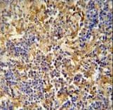 Polyclonal Rabbit anti-Human IBTK Antibody (aa586-613, IHC, WB)