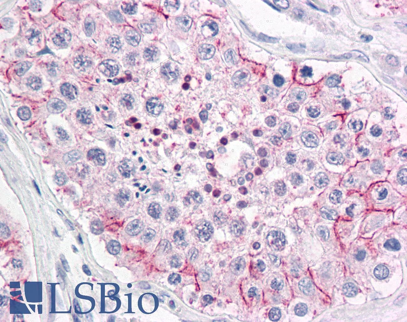 IHC-plus™ Polyclonal Rabbit anti-Human ERMP1 Antibody (Internal, IHC)