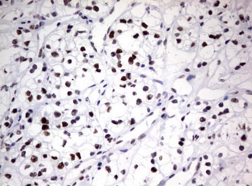 ZSCAN18 / ZNF447 Antibody (clone UMAB113)