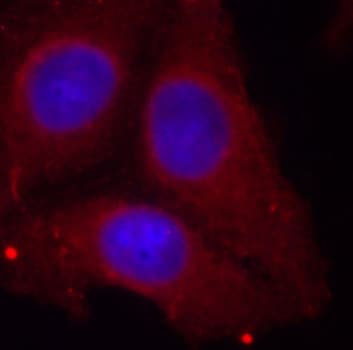 GAP43 Antibody (phospho-Ser41)